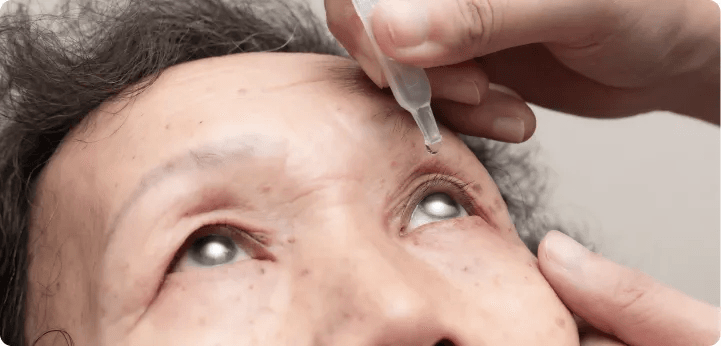 Glaucoma Screening Singapore