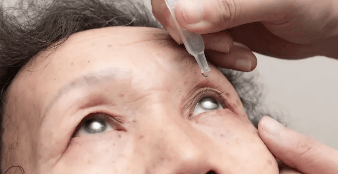 Jenis Glaukoma: Empat Jenis Utama